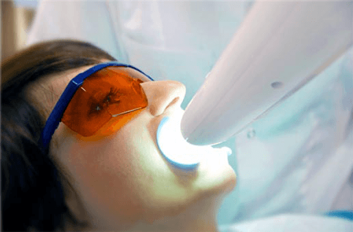 Understanding the Causes of Teeth Sensitivity Southall