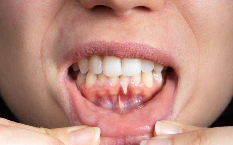 Final Thoughts: Building Lifelong Enamel Protection Habits Southall