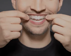 Overview of Home Teeth Whitening Kits Southall
