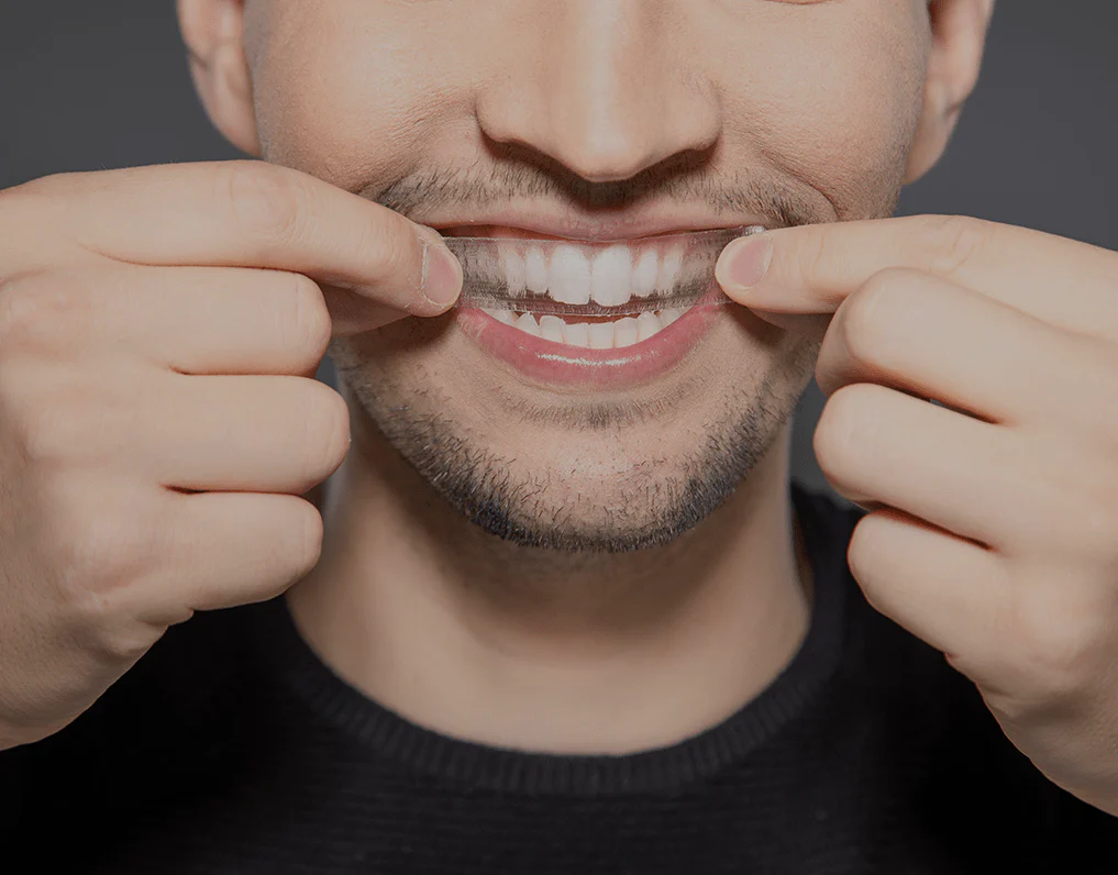 How Are Invisible Aligners Changing Orthodontic Treatments Southall?
