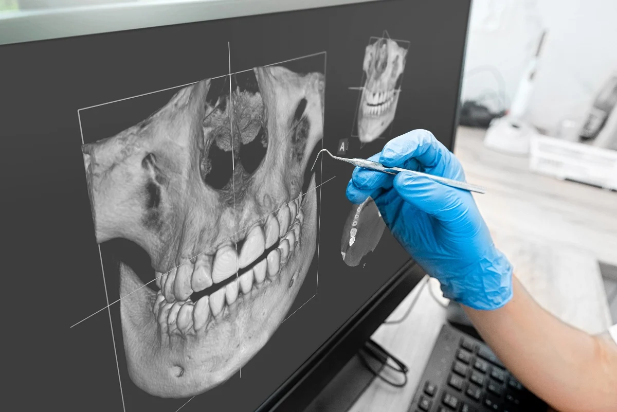 Key Benefits of 3D Printing for Patients and Dentists Southall