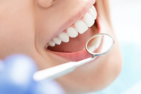 How Do You Choose the Right Cosmetic Dentist Southall?