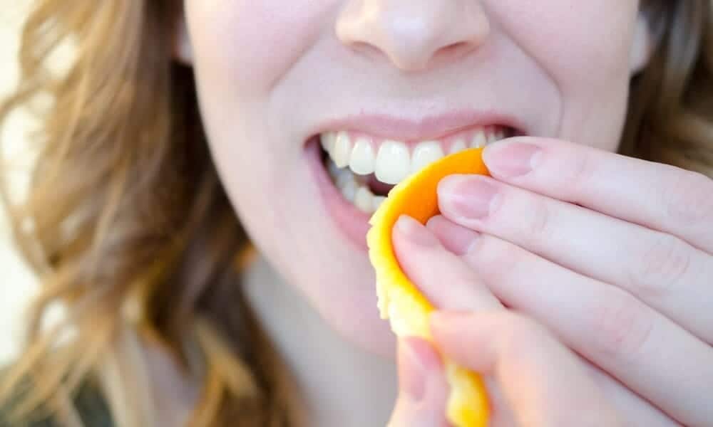 Are DIY Teeth Whitening Remedies Safe for Your Teeth and Enamel Southall?