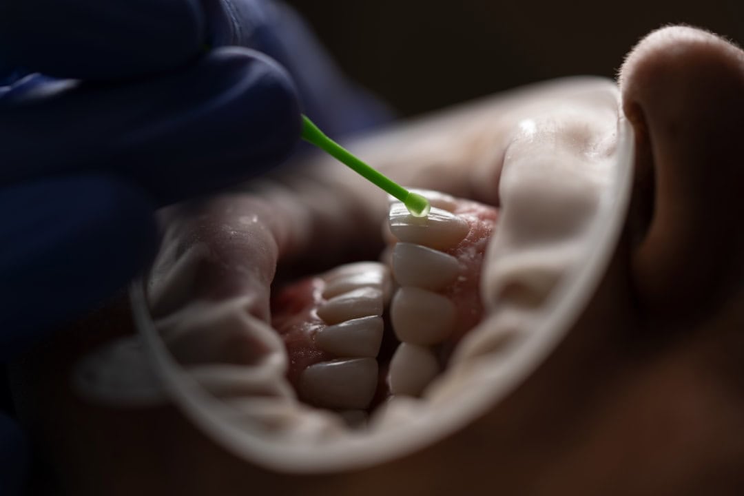 How Saliva Protects Your Teeth and Gums Southall