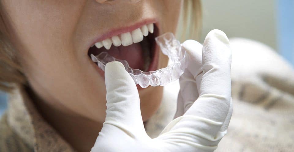 Can Bruxism Affect Your Sleep Quality Southall
