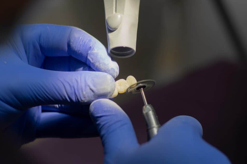 Customised Dental Solutions: Crowns, Aligners, and Implants Southall