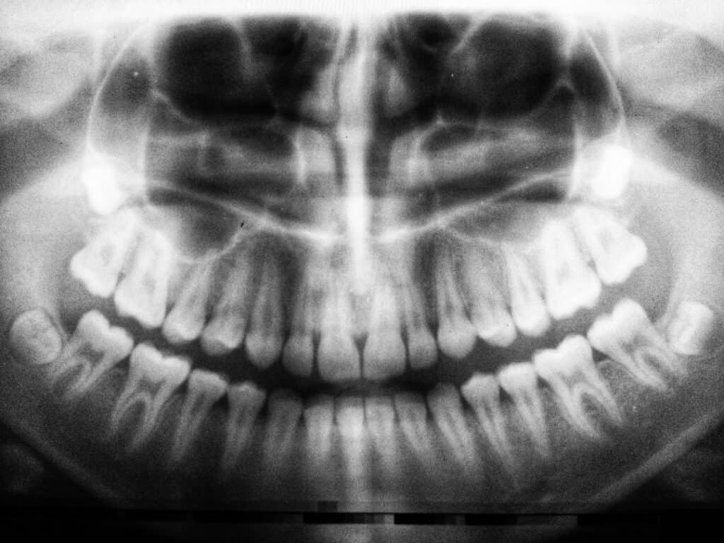 The Future of 3D Printing in Oral Healthcare Southall